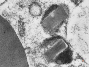 bone marrow - crystalloid inclusions Charcot-Leyden crystals formation bone marrow - crystalloid inclusions Charcot-Leyden crystals formation